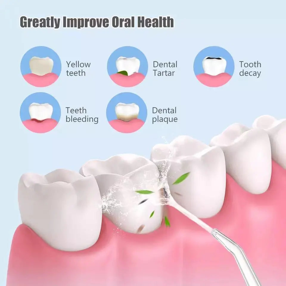 Luxialy Waterproof Irrigator Dental Cleaner